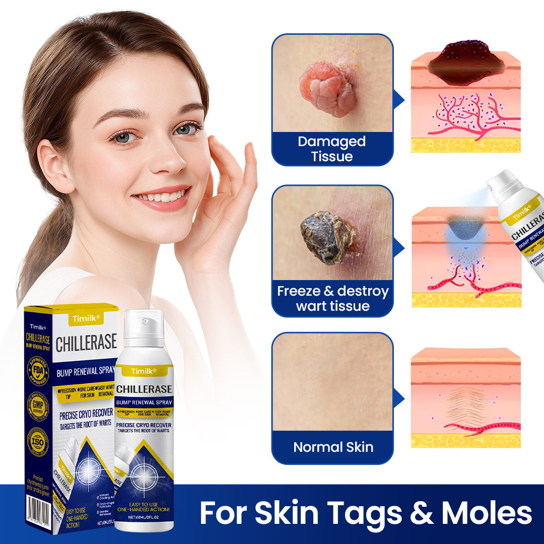 Timilk ChillErase® Bump Renewal Spray